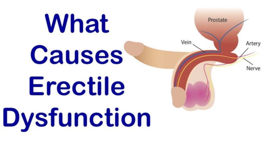 How to diagnose erectile dysfunction